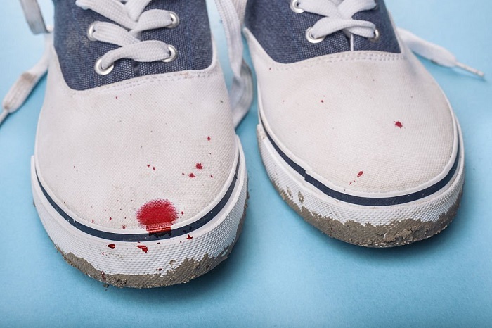How to Get Blood Out of Shoe